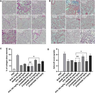 Virtual screening and activity evaluation of multitargeting inhibitors for idiopathic pulmonary fibrosis